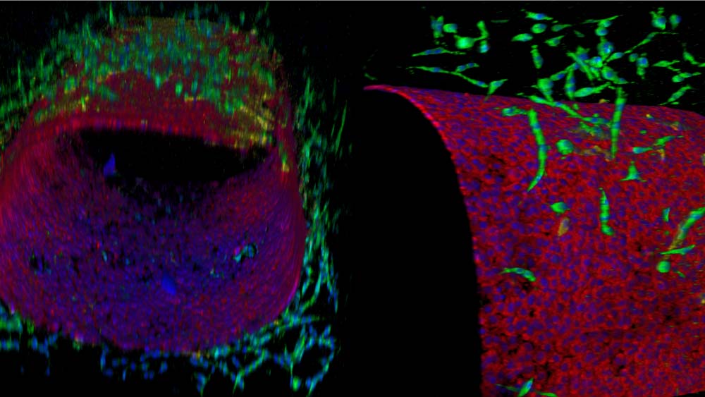 芯片上淋巴器官的显微视图。图像显示了一个由红色和蓝色的小点组成的圆柱形，周围环绕着绿色的卷须。