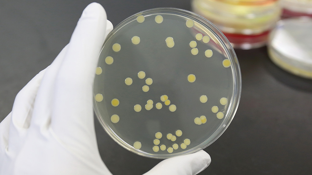 戴着手套的手拿着一个浅圆形的玻璃盘子，里面有培养的小圆形细菌细胞群